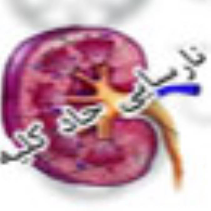 نارسايي حاد كليه