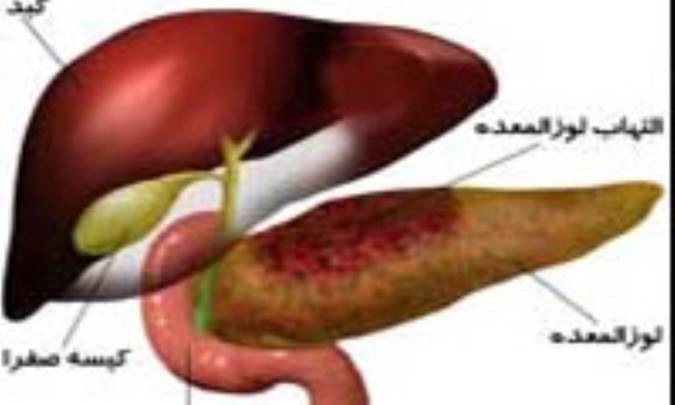 حقايق صفراوي