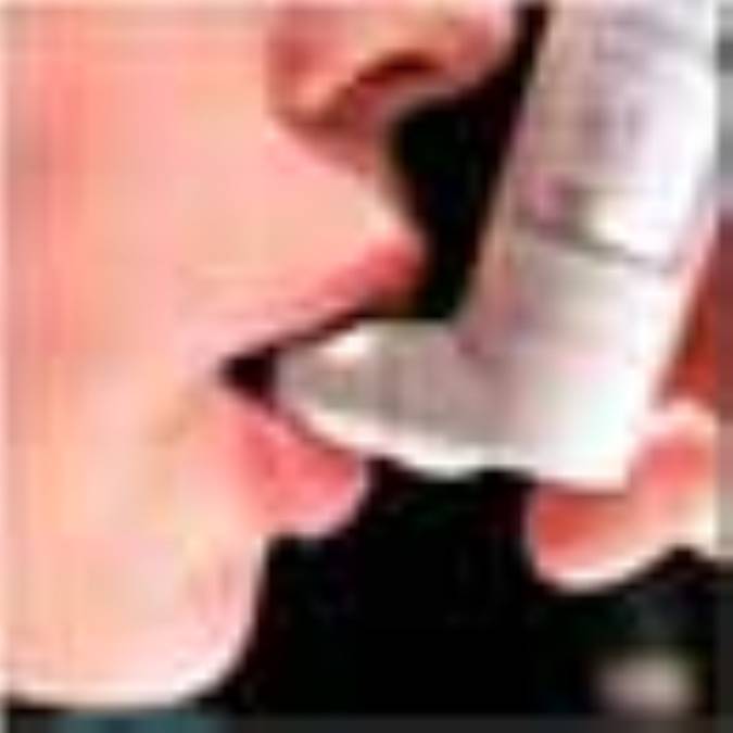 آسم چیست؟