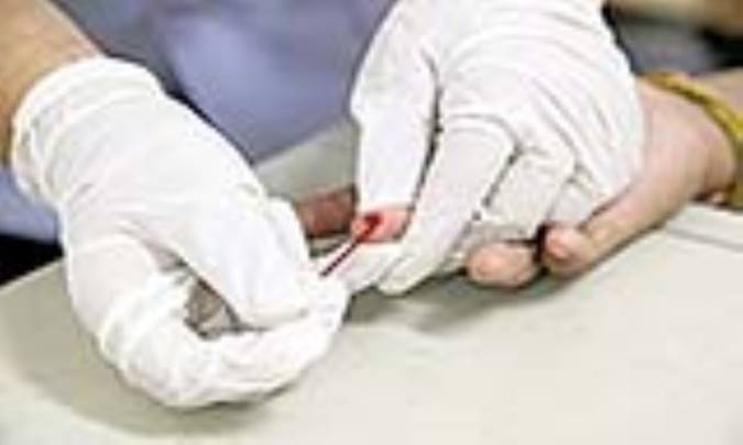 آلبومین چیست