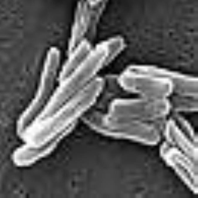 سل و شيوه هاي درمان آن