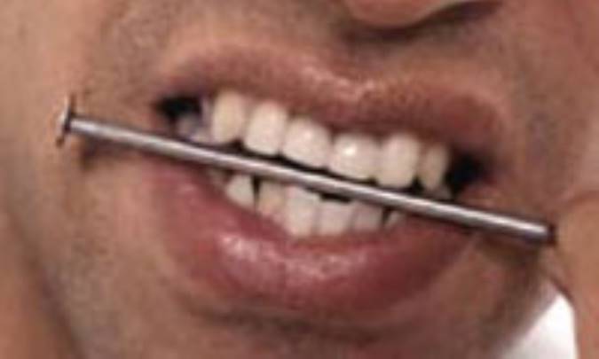 شغل ما بر شکل دندان‌هاي ما تاثير دارد!