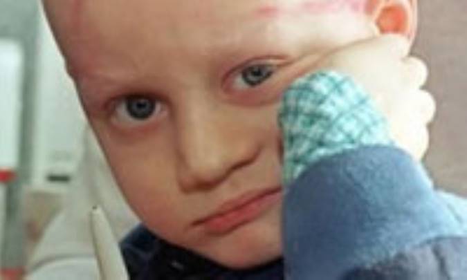 سرطان در كودكان