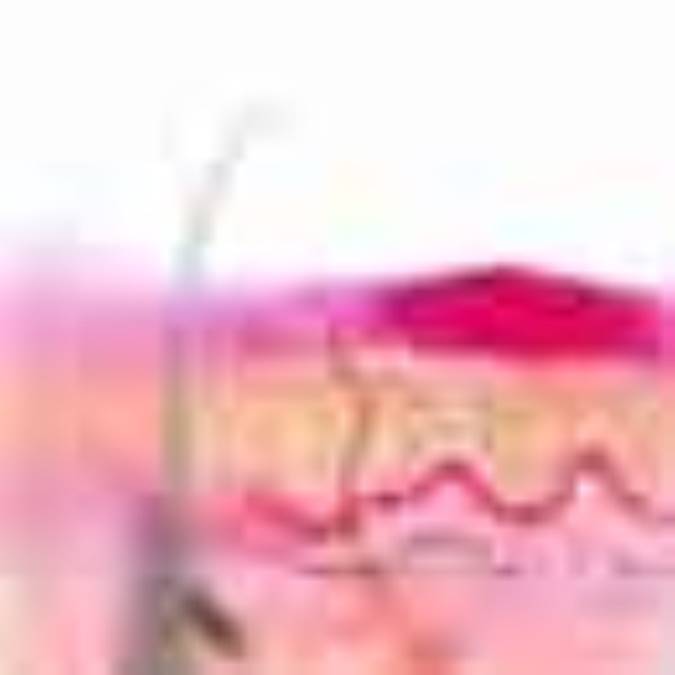 درمان سوختگى هاى ناشى از ليزر