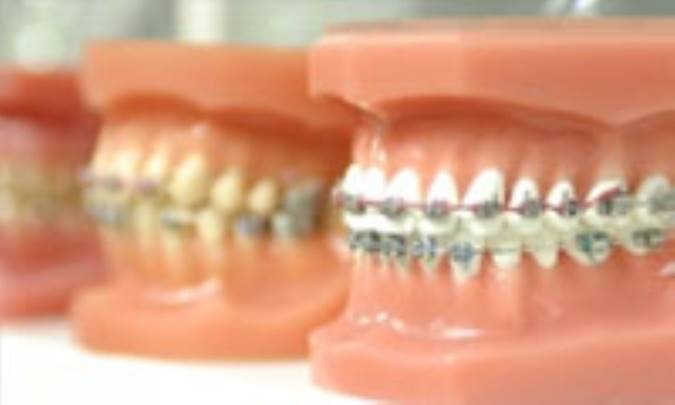 پرسش هايي پيرامون ارتودنسي