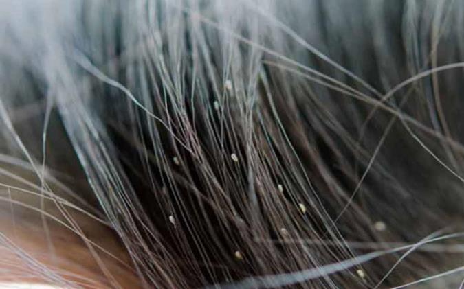 چگونه خانه را از شپش پاکسازی کنیم؟