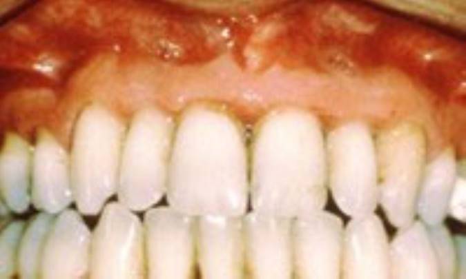 8 باور غلط درباره دندان‌ها