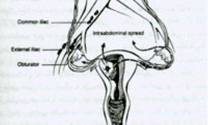آناتومی رحم و بیماریهای آن