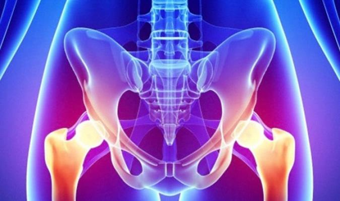 بیماری التهاب لگن در خانم‌ها