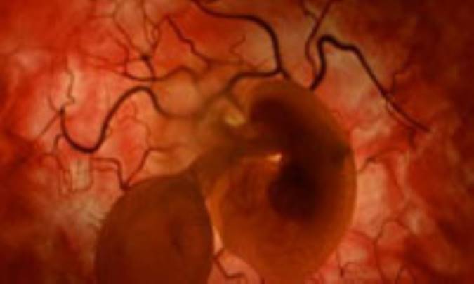 درد‌ها و درمان‌هاي فيبروم رحمي