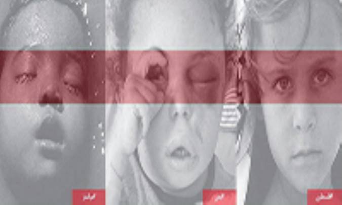 چشم انتظاران