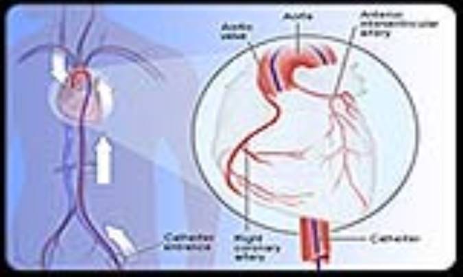 دی اکسید کربن به عنوان مادة حاجب