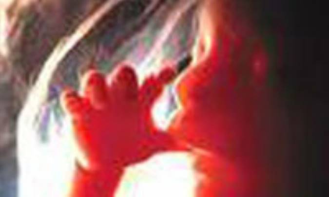 صداي قلب جنين، صداي دويدن اسب‌هاست!