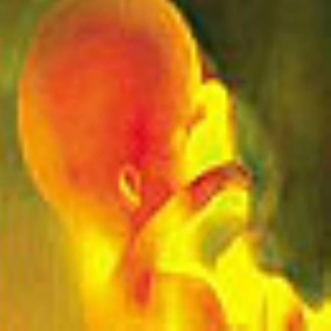 مراقبت های قبل از دوران بارداری!!