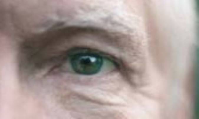 پيرچشمي از 40سالگي کليد مي‌خورد 