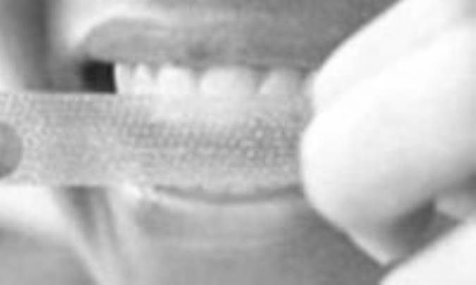 آرايشگاه، جاي بليچينگ نيست