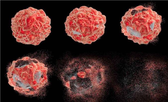 علائم سرطان را بشناسیم