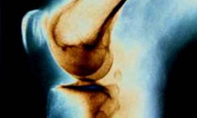 مصايب مفصل در فصل جواني