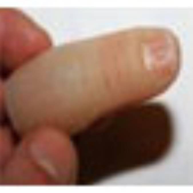 قطع اعضاي بدن چگونه انجام مي شوند ؟