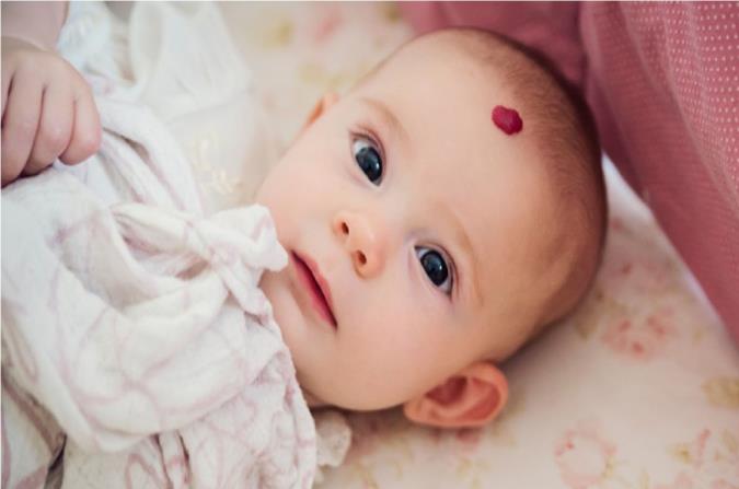 هرآنچه که باید راجع به ماه گرفتگی پوست بدانیم