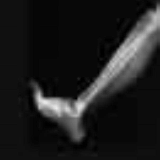 تغذيه دربيماريهای استخوان