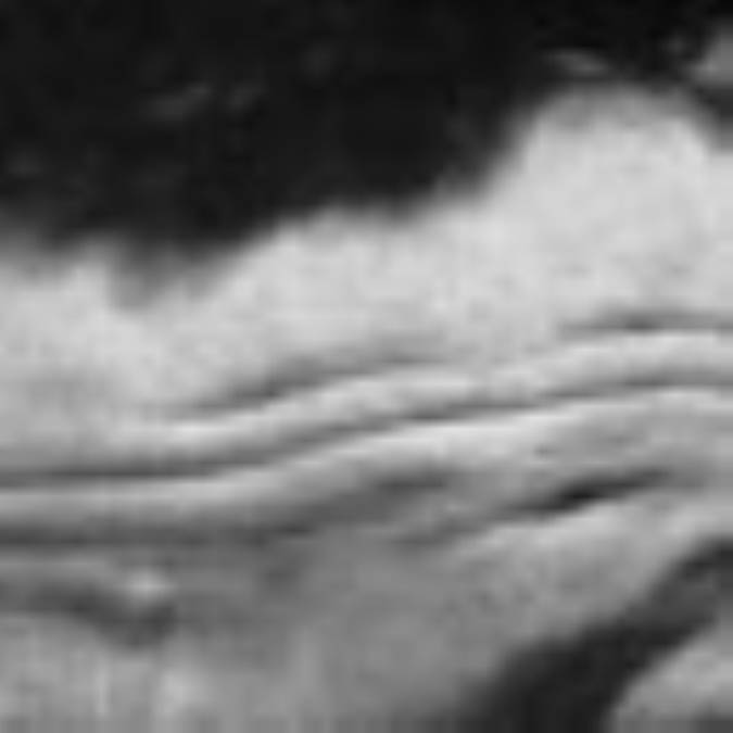 رفع چين و چروک