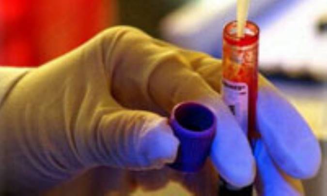 راهنماي تفسير نتايج آزمايش خون (1)