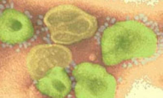 به‌ هم‌ خوردن‌ تعادل‌ كلسيم‌ خون‌