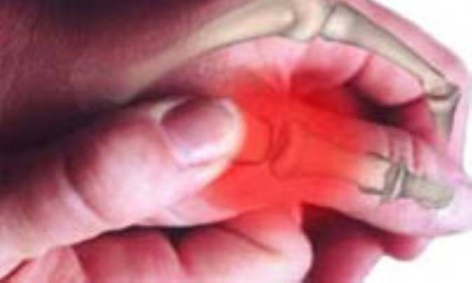 آرتروز در کمین خانم های خانه دار