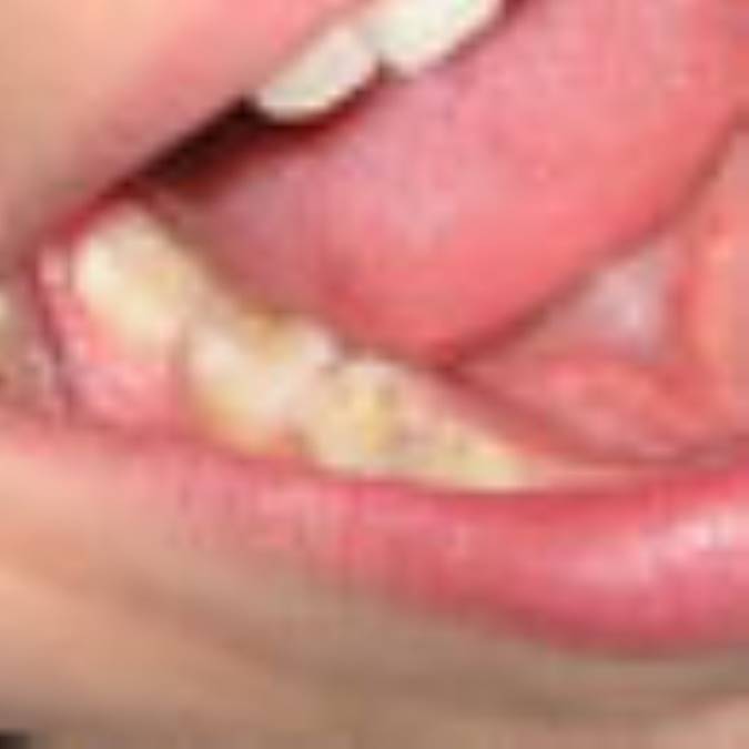 اصول آموزش بهداشت دهان و دندان به بچه‌ها 