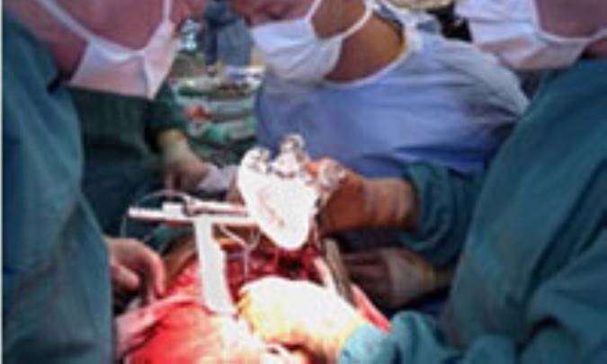 پيوند و خريد و فروش اجزاى بدن(2)