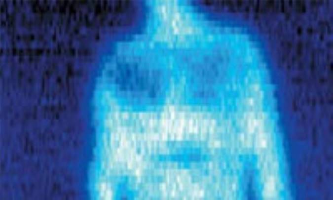 بيماري‌ ناشي‌ از تابش‌ اشعه‌