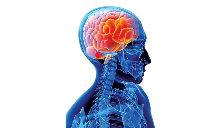 از علت تا درمان میلوفیبروز