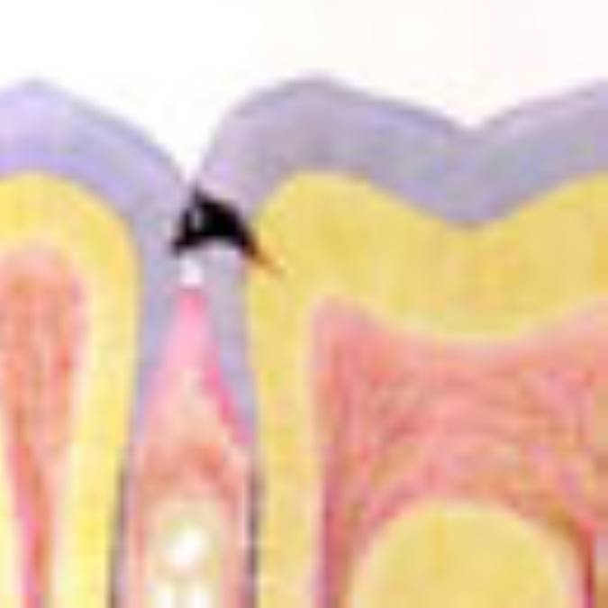 فوائد معالجه عصب دندان