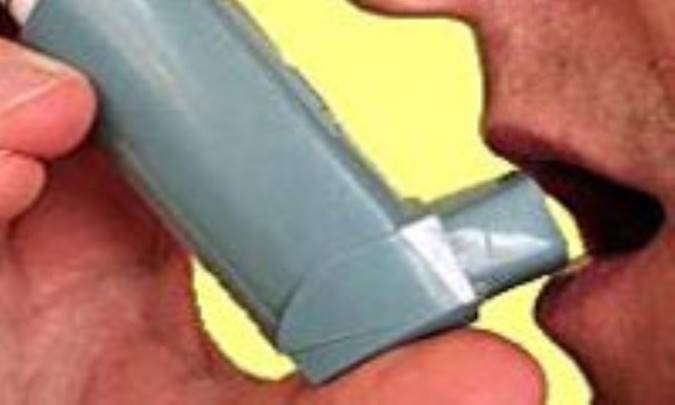 خانه‌هاي ضدآسم 34 ويژگي دارند