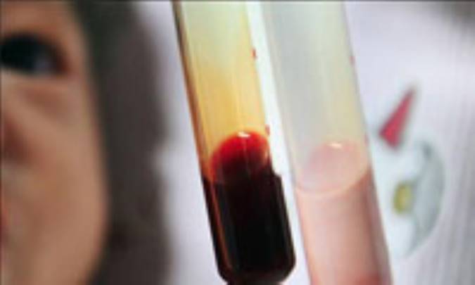 اختلال در تکامل کودک با کم‌خوني فقر آهن