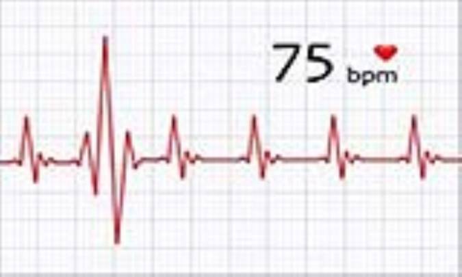 ضربان قلب طبیعی