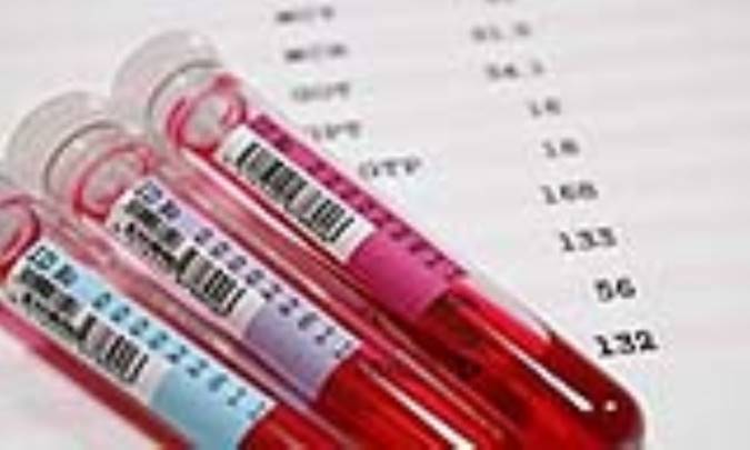 سطوح نرمال قند خون ناشتا