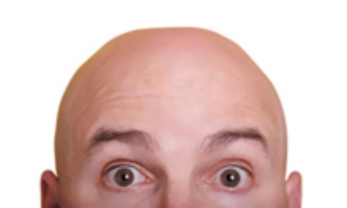 کچل