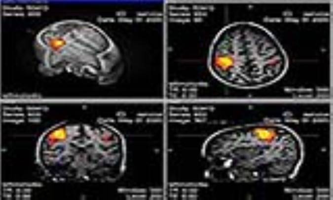 مغناطیس در پزشکی و زیست‌شناسی - 1