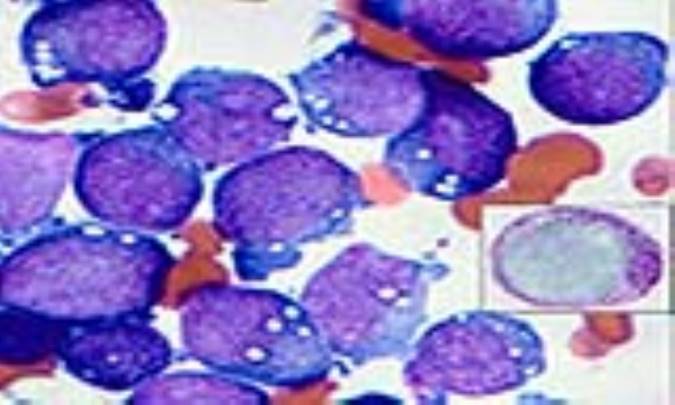 علل پان سیتوپنی