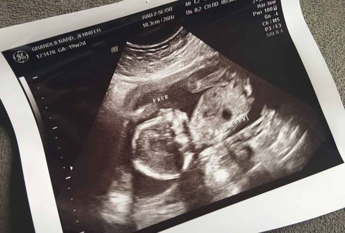 Image result for ‫سونوگرافی‌های تشخیصی و موارد خاص در بارداری‬‎