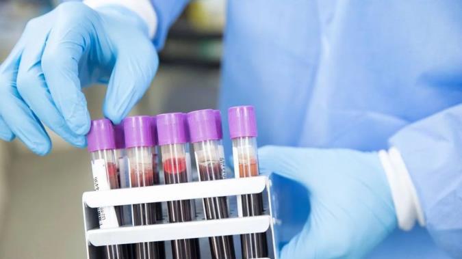 تولید کیت های جدید تشخیص سریع کرونا توسط شرکت‌های دانش بنیان علوم پزشکی