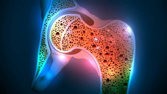 رونمایی از استخوان مصنوعی تولیدشده در ایران با فناوری پرینت سه‌بعدی