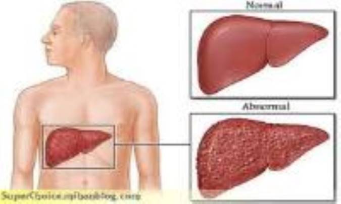 تغذیه مناسب برای سلامت کبد