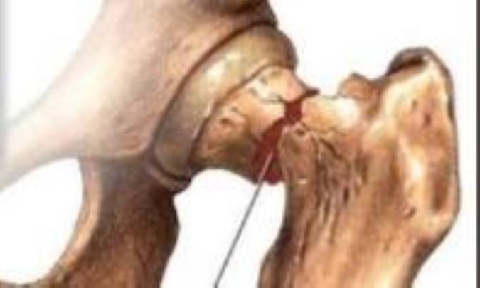 زنان سنجش تراکم استخوان را در سنین یائسگی فراموش نکنند