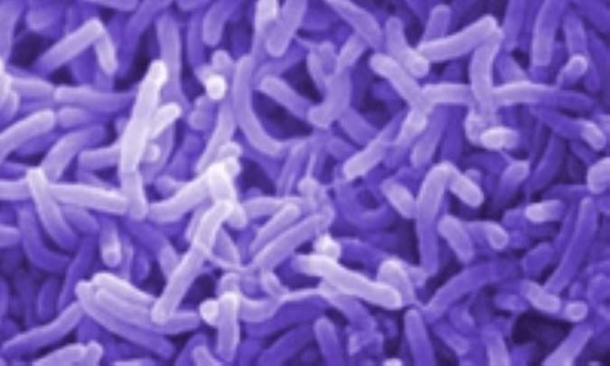 توصیه‌های سازمان بهداشت جهانی برای شناسایی ویروس شبه سارس