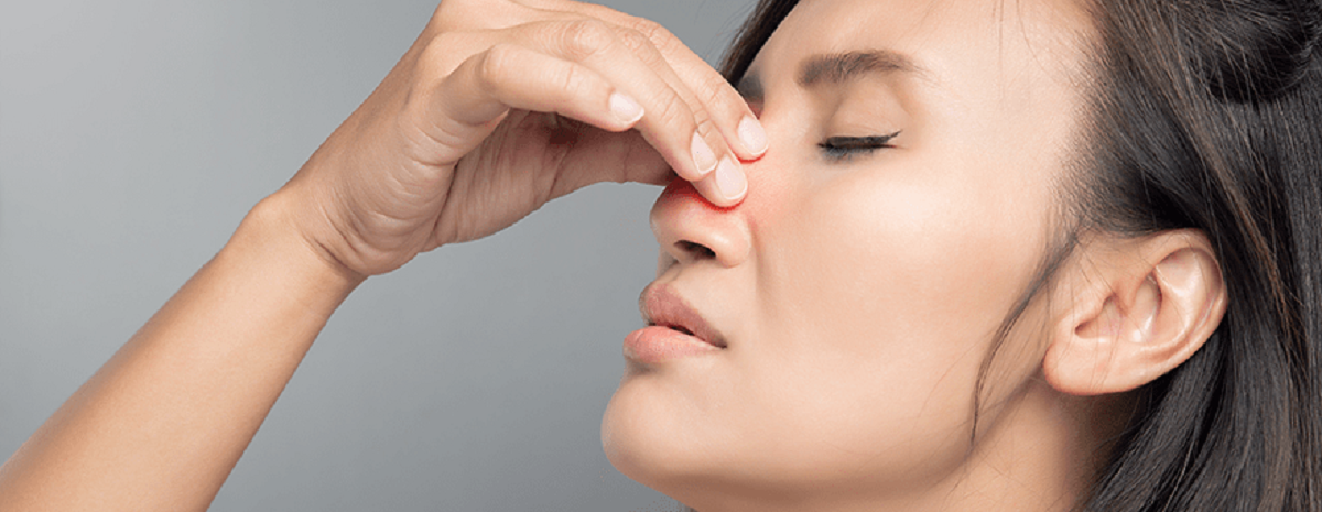 همه چیز درباره سینوزیت ، اطلاعات جامع درباره سینوزیت حاد همه چیز درباره سینوزیت ، اطلاعات جامع درباره سینوزیت حاد