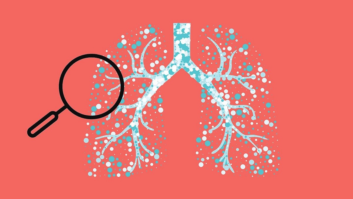 معضلی به نام آسم ، آیا درمانی برای آسم وجود دارد؟ معضلی به نام آسم ، آیا درمانی برای آسم وجود دارد؟