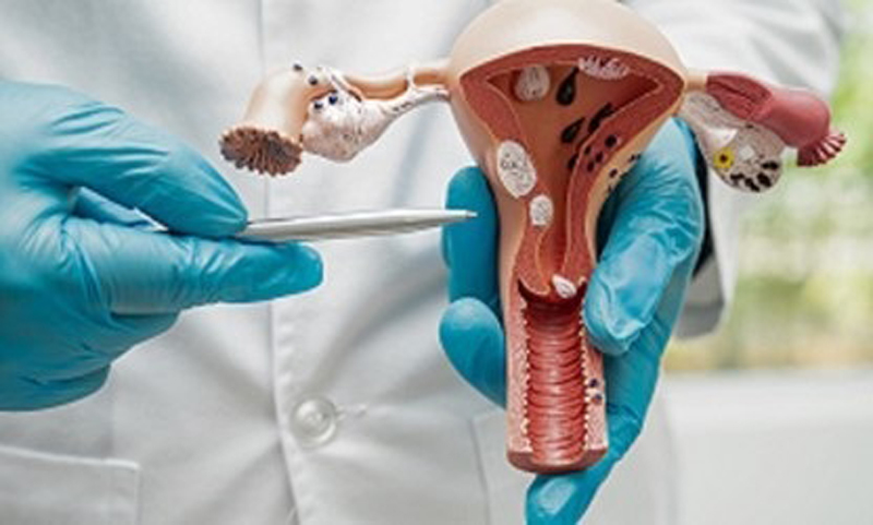 علائم HPV در زنان چیست؟ + انواع HPV